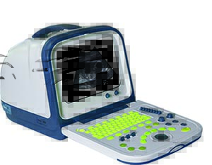 st-14